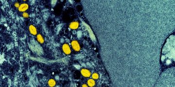 Europa eleva risco de mpox após registro de nova cepa na Suécia: ‘devemos estar preparados para mais caso