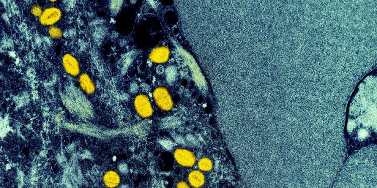 Europa eleva risco de mpox após registro de nova cepa na Suécia: ‘devemos estar preparados para mais caso