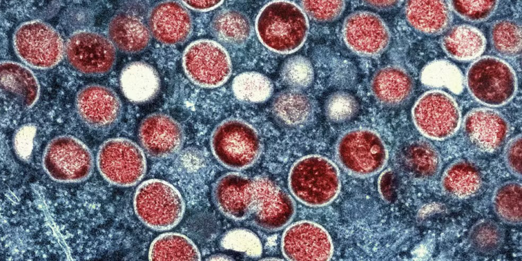 Mpox volta a ser uma emergência sanitária global, diz OMS; tire dúvidas em 10 tópicos